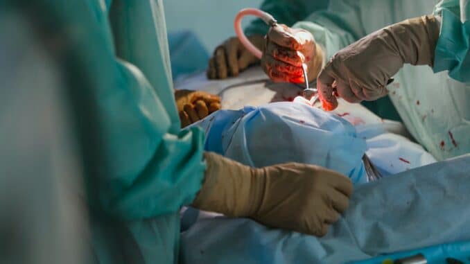 doctor doing operation