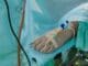 a person in a hospital bed with an iv